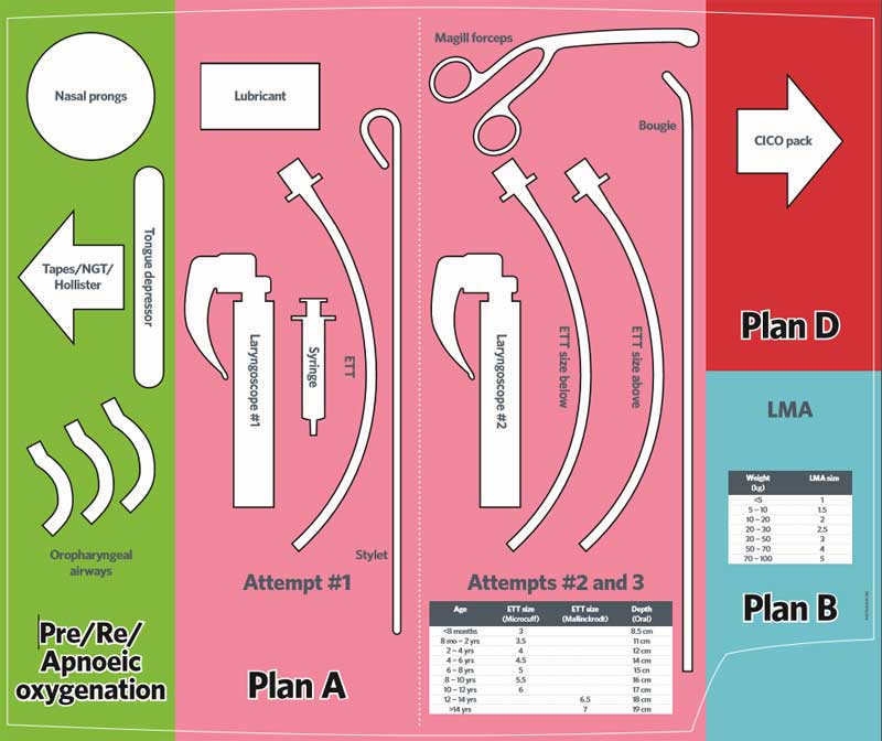 airway-plan-kit-dump-ki-doc